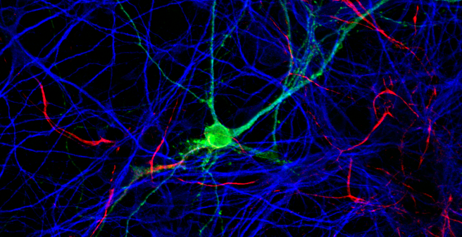 Contentbuhnenthema Neuron